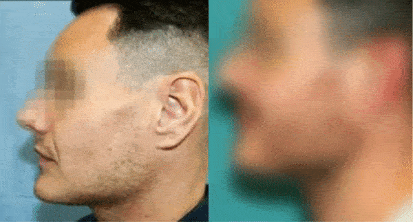 opinione barba plus