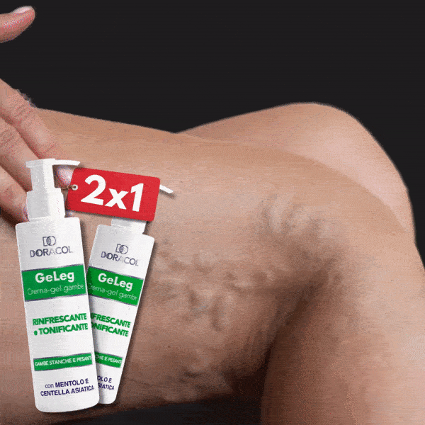 gel vene varicose come applicare
